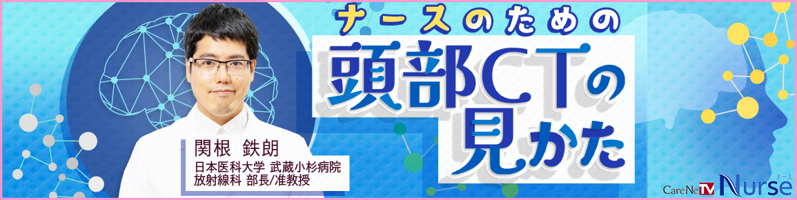 ナースのための頭部CTの見かた　バナー
