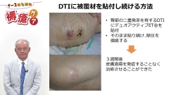 ナースのための褥瘡ケア|被覆材とケア方法の選択