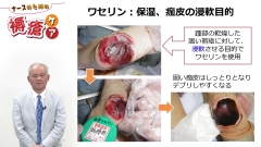 ナースのための褥瘡ケア|褥瘡患者に対する院内情報共有の工夫