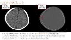 【資料・受講証明書付き】ナースのための頭部CTの見かた|【資料・受講証明書付き】ナースのための頭部CTの見かた 【資料・受講証明書付き】ナースのための頭部CTの見かた|【資料・受講証明書付き】ナースのための頭部CTの見かた