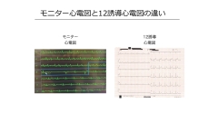 【リアタイ配信】薬剤師・看護師のための基礎から学ぶ心電図セミナー|第1回　12誘導心電図を理解するための心臓解剖（薬剤師・看護師共通）