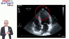 ナースのための心エコーレポートの読み方|疾患別！エコーの見かたとレポートのポイント