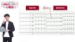 ナースのための心臓解剖から理解する心電図|モニター心電図を見る際に必ず確認すべき点