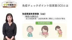 【資料・受講証明書付き】今はこうするケアの根拠5～8　救急・ICU・外来・在宅|第7巻　外来看護「ICI治療中の患者が『だるさ』を訴えたらirAEを疑う」