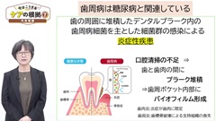 【資料・受講証明書付き】今はこうするケアの根拠5～8　救急・ICU・外来・在宅|第7巻　外来看護「歯周病は糖尿病と関連している」