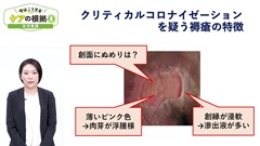 【資料・受講証明書付き】今はこうするケアの根拠5～8　救急・ICU・外来・在宅|第8巻　在宅看護「難治性褥瘡治療ではクリティカルコロナイゼーションを見きわめる」