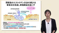 知らないと困る！骨粗鬆症|第1回　機序と疫学