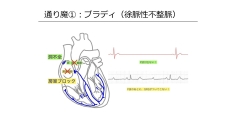 【資料・受講証明書付き】心電図検定4級対策　薬剤師・看護師のための基礎から学ぶ心電図セミナー|第2回　刺激伝導系と心電図波形／徐脈性不整脈（薬剤師・看護師共通）