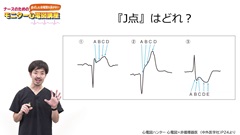 ナースのための必ずしも心電図を読まないモニター心電図講座|徐脈　後編