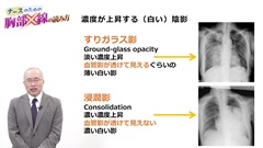 ナースのための胸部X線の読み方|胸部X線写真の見かた 左右の比較