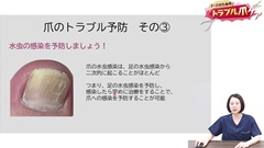 ナースのためのトラブル爪ケア|爪のトラブル予防