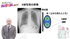 【資料・受講証明書付き】ナースのための胸部X線の読み方＆画像クイズ|ナースのための胸部X線の読み方