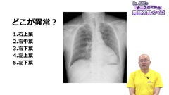 【資料・受講証明書付き】ナースのための胸部X線の読み方＆画像クイズ|Dr.長尾のナースのための胸部X線クイズ