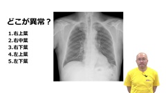 【資料・受講証明書付き】ナースのための胸部X線の読み方＆画像クイズ|【おまけ編】Dr.長尾のナースのための胸部X線クイズ