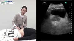 ナースのための膀胱・直腸エコー|排便ケア・直腸エコー編