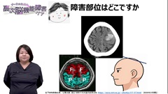 【資料・受講証明書付き】ナースのための高次脳機能障害ケア　病態と看護がつながる基礎知識|【資料・受講証明書付き】ナースのための高次脳機能障害ケア　病態と看護がつながる基礎知識