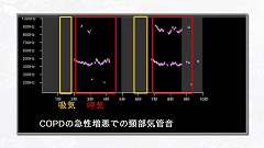 【受講証明書付き】Dr.皿谷の肺音聴取道場（全10回）|第5回　頸部で聴こえる音