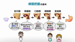 【受講証明書付き】Dr.野原のナルホド！摂食・嚥下障害マネジメント　～キュアからケアへ～（全13回）|第2回　おじいちゃん、何で食べられへんの？大事なのは診断と病態把握