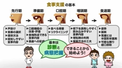 【受講証明書付き】Dr.野原のナルホド！摂食・嚥下障害マネジメント　～キュアからケアへ～（全13回）|第8回　せっかく飲み込んだのに・・・　食道期の障害への食事支援