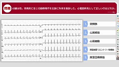 【受講証明書付き】Dr.翼の心電図検定3級合格ポイント塾（全10回）|第8回　発作性上室頻拍