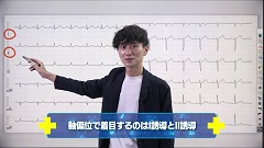 【受講証明書付き】Dr.翼の心電図検定3級合格ポイント塾（全10回）|第9回　軸偏位