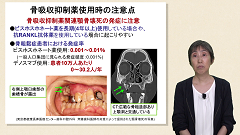 【受講証明書付き】知らないと困る！骨粗鬆症（全7回）|第6回　薬物療法の注意点
