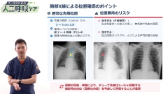 【資料・受講証明書付き】ナースのための人工呼吸ケア　挿管介助～抜管までの看護と挿管中のリハビリテーション|【資料・受講証明書付き】ナースのための人工呼吸ケア　挿管介助～抜管までの看護と挿管中のリハビリテーション