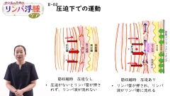 ナースのためのリンパ浮腫ケア|リンパドレナージと圧迫療法の選択