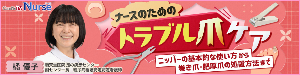 ナースのためのトラブル爪ケア