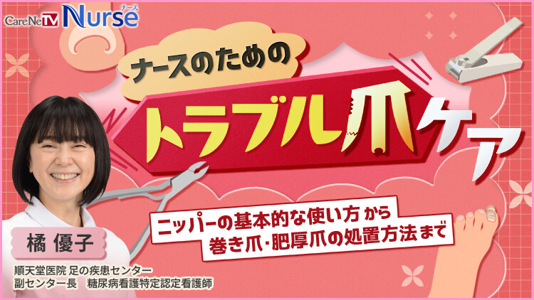 ナースのためのトラブル爪ケア