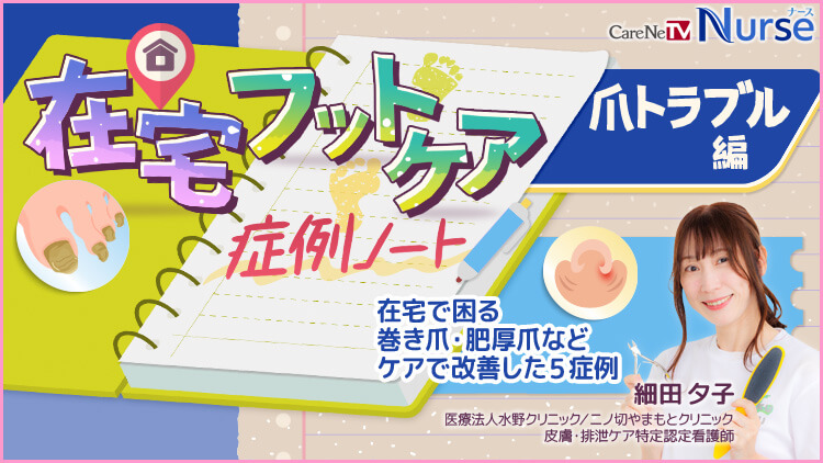 在宅フットケア症例ノート　爪トラブル編