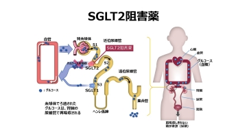 ナースのための糖尿病治療薬ガイド