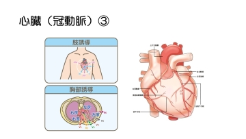 【資料・受講証明書付き】ナースのための心筋梗塞の重症度アセスメントと看護ケア