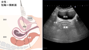 【資料・受講証明書付き】ナースのための膀胱・直腸エコー