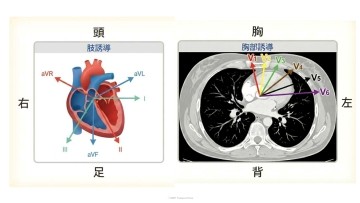 ナースのための心臓解剖から理解する12誘導心電図