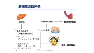 ナースのための肝胆膵の血液検査データの読み方