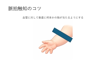 ナースのための子どもの看かた