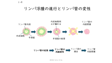 【資料・受講証明書付き】ナースのためのリンパ浮腫ケア