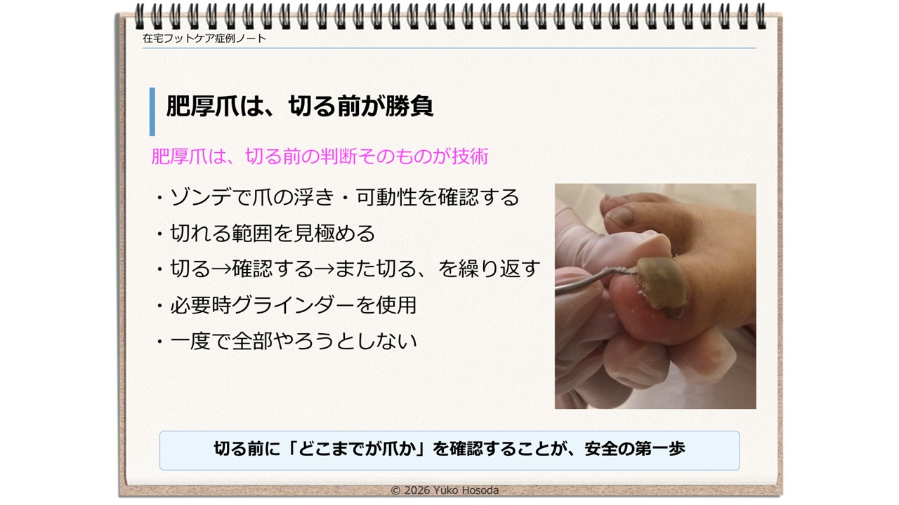 【資料・受講証明書付き】在宅フットケア症例ノート　爪トラブル編
