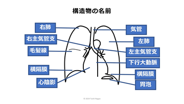 ナースのための胸部X線の読み方