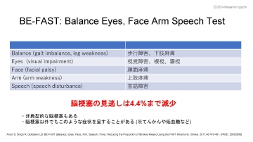 ナースが知っておくべき脳卒中治療と管理