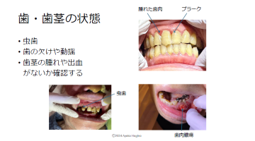 【資料・受講証明書付き】実技動画付き！ナースのための口腔ケア
